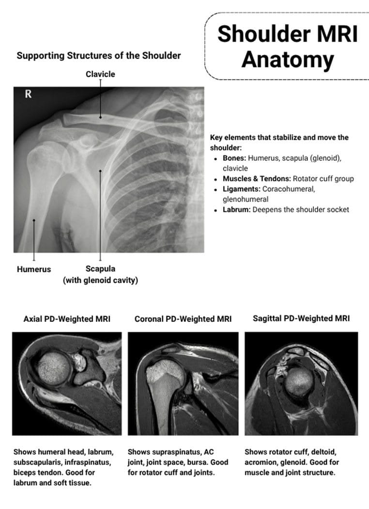 Shoulder MRI Anatomy