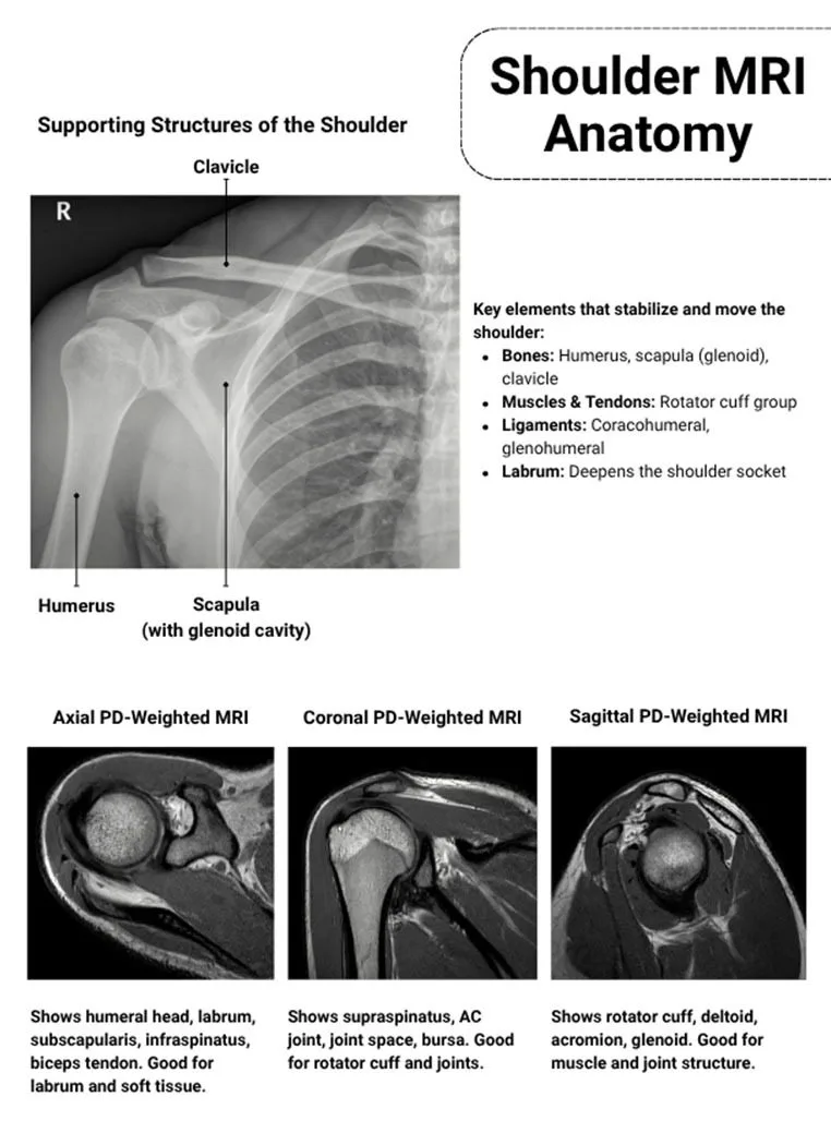 Mri Pa Shoulder Shoulder Anatomy Radiology Imaging Mri