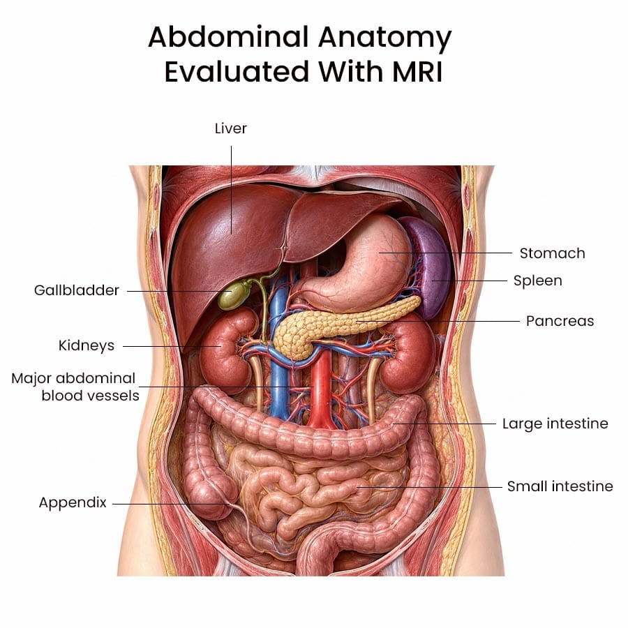 Abdominal MRI anatomy illustration showing the liver, gallbladder, pancreas, kidneys, spleen, stomach, intestines, and major abdominal blood vessels.