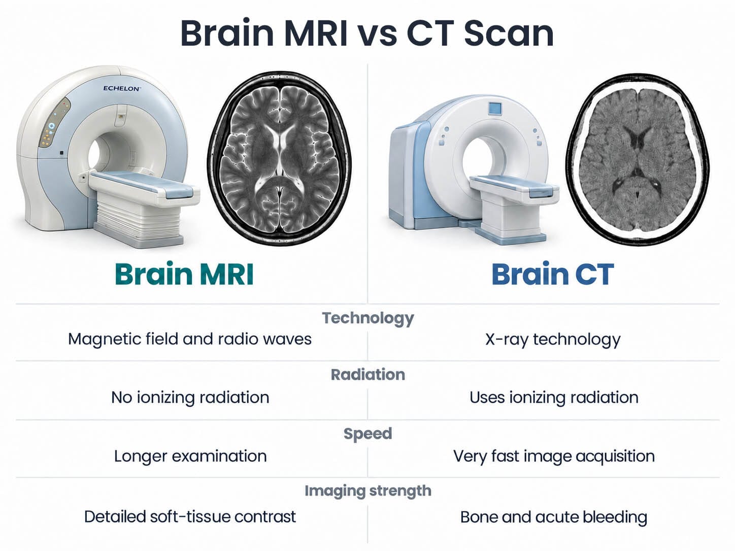 Brain MRI vs CT scan comparison showing differences in technology, radiation, speed, and imaging strengths