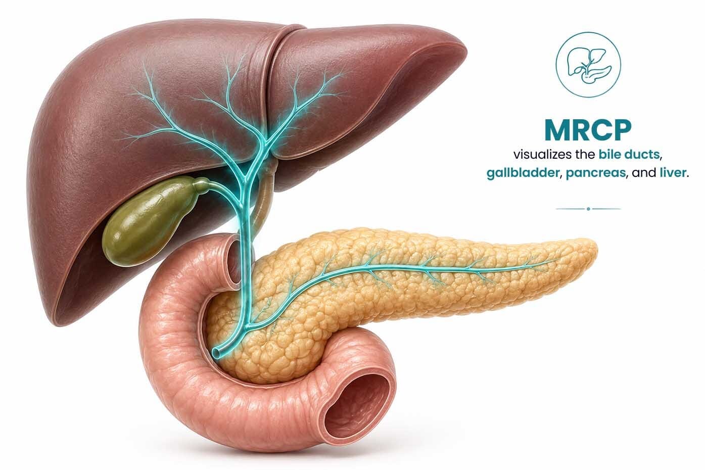 MRCP anatomy showing the bile ducts, gallbladder, pancreas, and liver examined with magnetic resonance cholangiopancreatography.