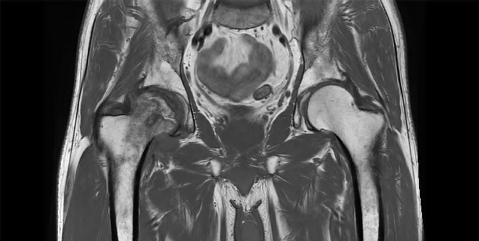 Pelvic and hip MRI imaging in Midtown Manhattan